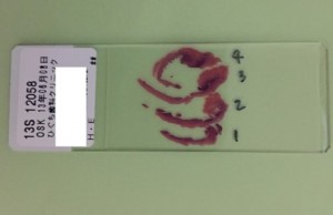 bml1