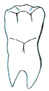 taurodonto3