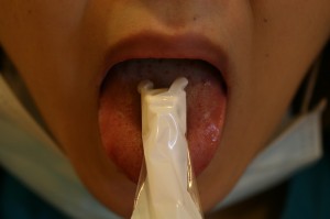 mucus1
