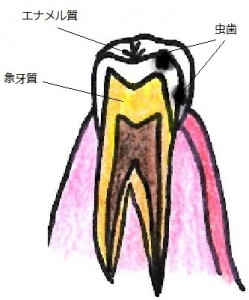 kodomoenamerushituusyoku