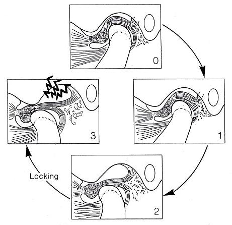 クローズドロック時の顎関節の構造と動き