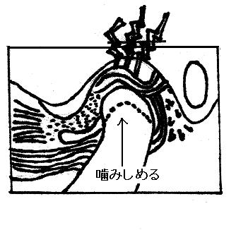 関節円板の移動