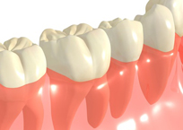 STEP.6-1　歯や神経を削らず・取らず・抜かずに治療