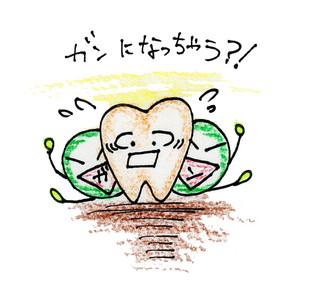 がん化するかもしれない口腔病変 - ひぐち歯科、口腔外科・口腔内科