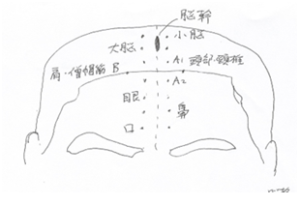 顔面痙攣の針治療